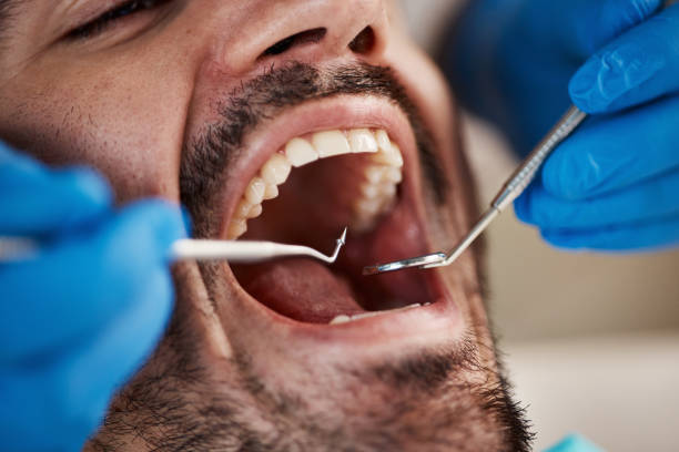 Best Emergency Dental Surgery in Doffing, TX